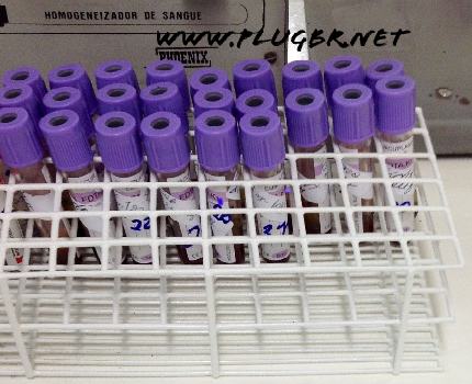 Exame de sangue hemograma