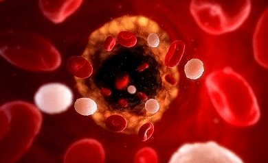 O que significa nao reagente no exame de hiv