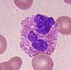 Eosinófilo, uma célula do sangue que aumenta em parasitoses