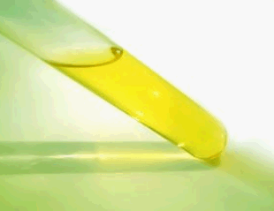Antiestreptolisina O, ASLO - Indicador de infecções estreptocócicas
