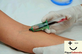 Exame de HIV - Recomendações para realização em caso de exposição a situação de risco