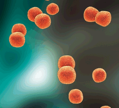 Meningite bacteriana, um caso positivo no exame laboratorial