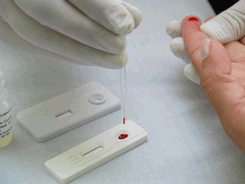 Teste rápido para HIV, coleta de sangue em papel de filtro e outras novidades