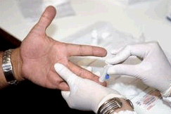 teste-rapido-hiv-aids teste-rapido-hiv-aids
