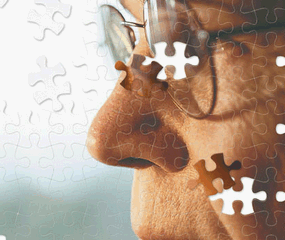 Alzheimer - Diagnóstico precoce, exames e as novidades nas pesquisas