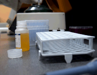 Teste de drogas para concurso público e o tempo que o crack fica no cabelo e na urina