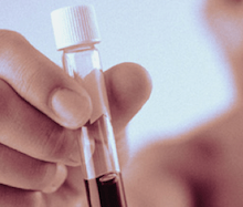 HIV - Faça o teste, não custa nada saber é a melhor decisão