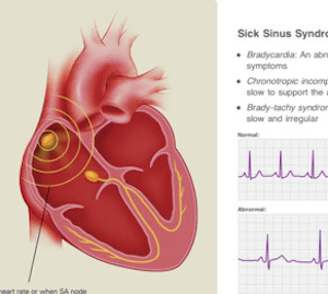 cardio-ipad-app cardio-ipad-app