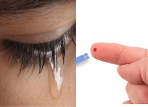 lagrima-sangue-exame lagrima-sangue-exame