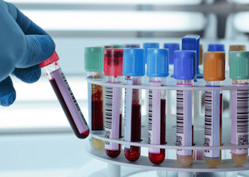 Quanto tempo vale um exame de sangue