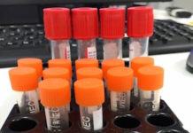 O que significa inr no exame de sangue