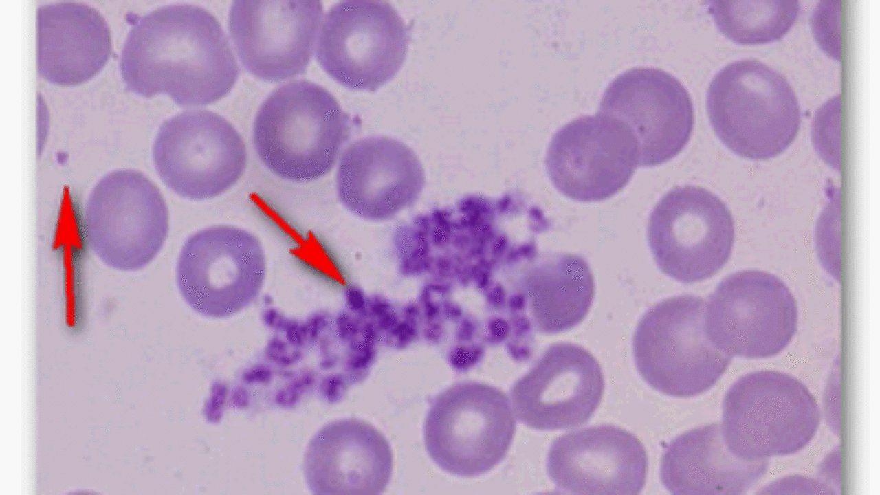 Hemograma valores normales en ninos pdf