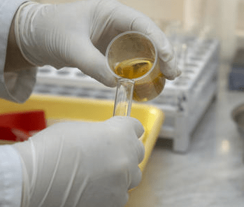 Como ver resultado de exame de sangue pela internet Como ver resultado de exame de sangue pela internet