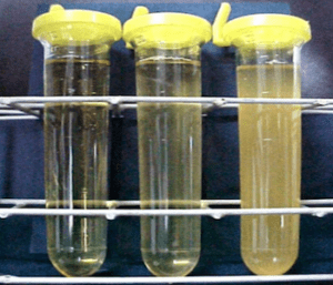 exame de urina nitrito positivo tomar medicamento