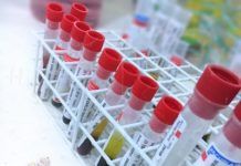 Exame de sangue ca 125 para que serve