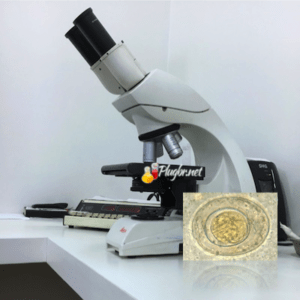 Hymenolepis nana ovos microscópio exame de fezes