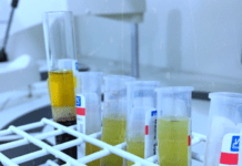 Exame de sangue vitamina k