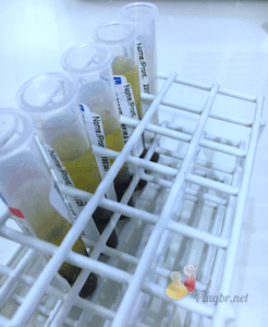 Exame colinesterase em intoxicação por inseticidas organofosforados