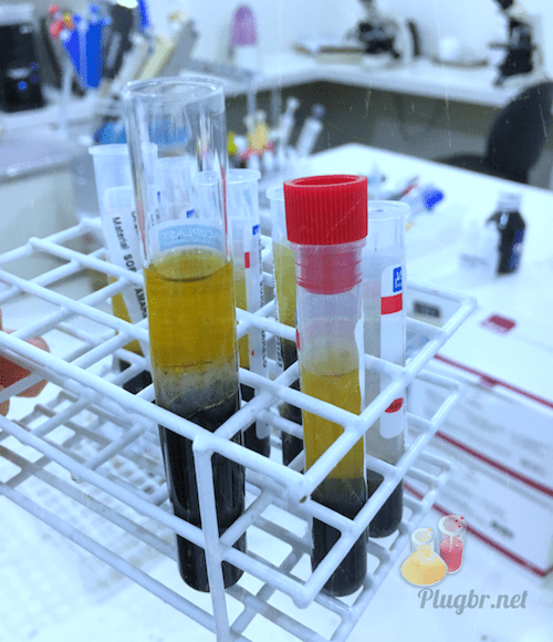 Anticorpos Anti JO 1 como coletar o sangue e quando ocorre resultado
