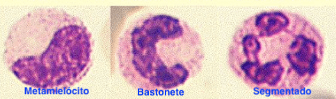Bastonetes Aumentados No Resultado Do Exame Hemograma, O Que Indica ...