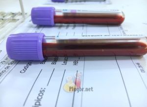Exame de sangue hemograma bastonetes