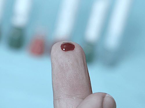 exame tempo de sangramento - Plugbr