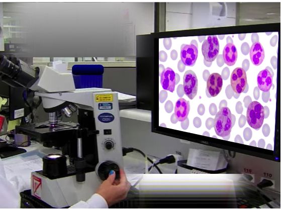 leucocitose hemograma - Plugbr