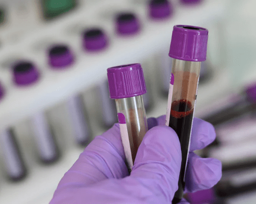 O Que é VPM No Exame De Sangue Hemograma O Que Significa | Plugbr.net
